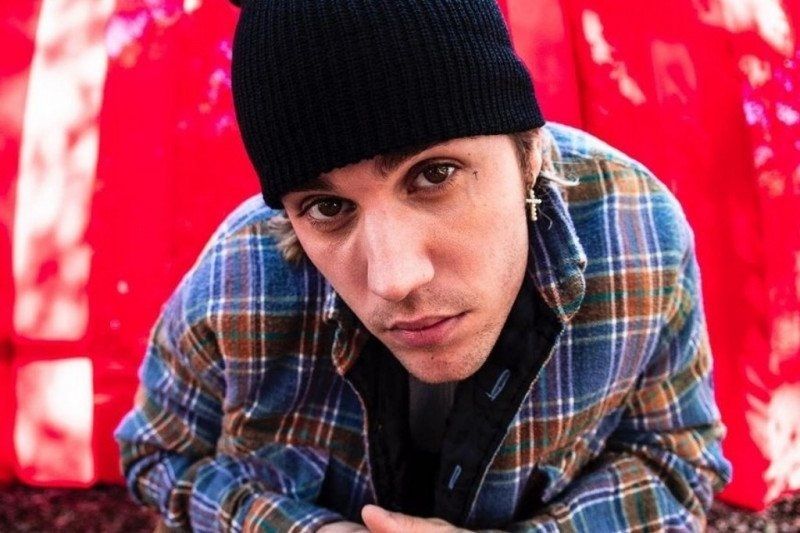 Justin Bieber umumkan separuh wajahnya lumpuh