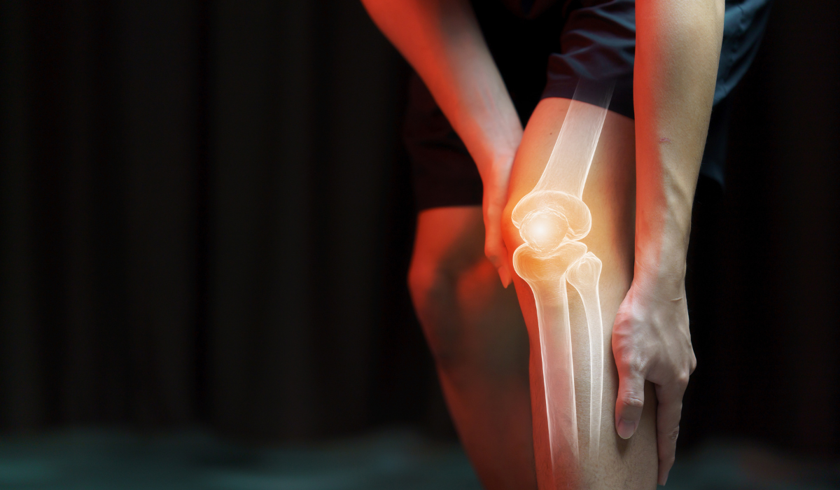 Mengapa Lebih Banyak Perempuan Mengalami Nyeri Lutut?